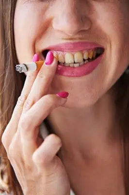 Rauchen macht Zähne gelb