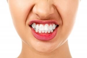 abgeschliffene zähne durch kieferpressen und Zähneknirschen