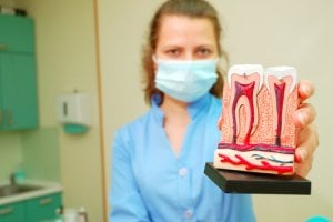 Alternative Mittel stehen bei einer Zahnwurzelentzündung nicht wirklich zur Debatte.