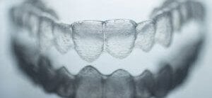 Zahnstein radierer - Betrachten Sie dem Favoriten der Experten