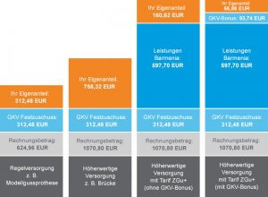 Überblick über die verschiedenen Tarife der Barmenia Direkt, mit den möglichen Einsparungen.