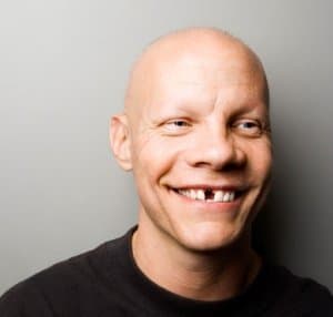 Ein Mann mit Zahnlücke im Frontzahnbereich, der ein breites Lächeln hat, ist abgebildet.
