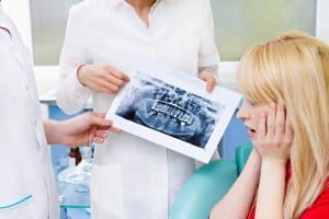 Zahnwurzelentzündung auf dem Röntgenbild