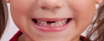 Children oral health