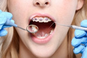 Zahnarzt untersucht Patientin mit fester Zahnspange