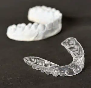 Invisalign Alternativen: Wettbewerber und Zahnkorrektur von zu Hause aus - Zahnabdruck