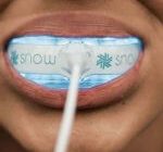Snow Teeth Whitening Kit Erfahrungen: Funktioniert das Bleaching-Set?