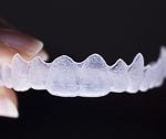 17995Feste Zahnspange: Welche Zahnspange-Brackets die richtigen sind