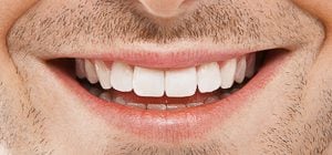 Zahnzusatzversicherung bei fehlenden Zähnen: Was gibt es zu beachten?