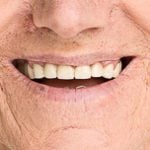 17913Weiße Zähne gelten nach wie vor als Inbegriff eines schönen Lächelns