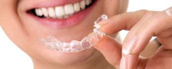 Invisalign Krankenkasse Kostenübernahme