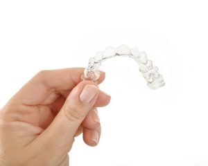 von zahnspange zu invisalign wechseln