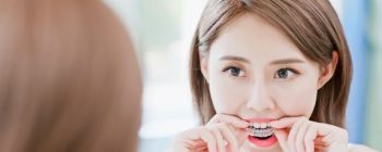 invisalign bei schwangerschaft