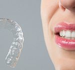 24636Mundfäule (Stomatitis Aphtosa): Herpes auf Zunge, Gaumen und Lippen