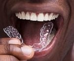 27691Feste Zahnspange: Welche Zahnspange-Brackets die richtigen sind