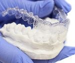2466810 Dinge, die man über die Invisalign Zahnspange wissen sollte