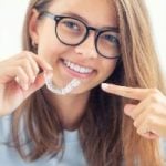 Aligner Zahnlücke – Diastema schließen ohne Zahnspange