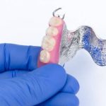35918Schöne und gerade Zähne: Wann braucht man eine Zahnspange?