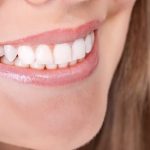 35897Gerade Zähne mit Alignern: Wie läuft die Invisalign Behandlung ab?