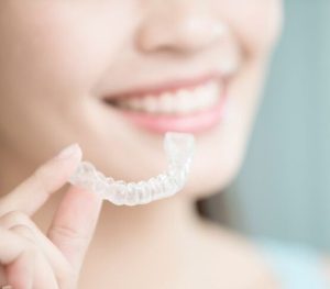 Invisalign kosten monatlich