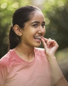 invisalign tragezeit verkuerzen