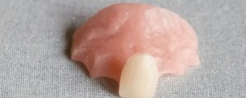 Prothese für einen Zahn