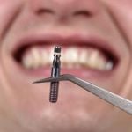 73379Baby Zähne: Wenn sich erste Zähne beim Zahnen zeigen