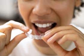 suresmile vs invisalign