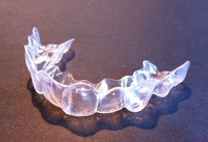 Invisalign full treatment