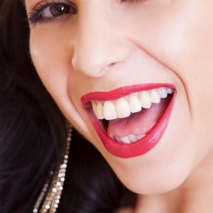 cosmetic dentistry teeth whitening cost