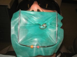 using a dental dam for root canal therapy