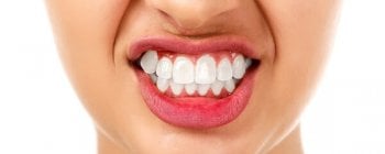 Problems with teeth clenching and grinding