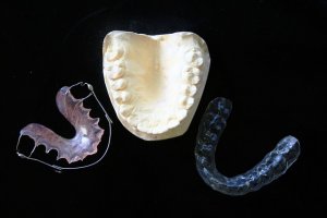 invisible braces uk 