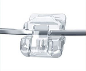 damon clear braces bracket