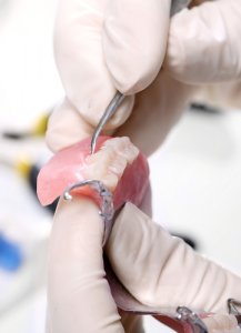 all-on-4 dental implants cost poland