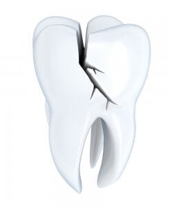 crack in tooth
