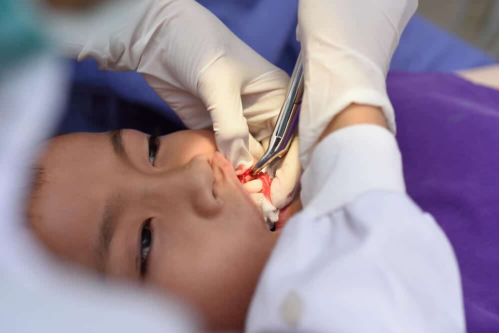 Tooth Extraction Procedure, Costs, Healing & Pain Relief