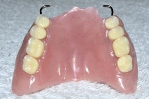 acrylic partial denture
