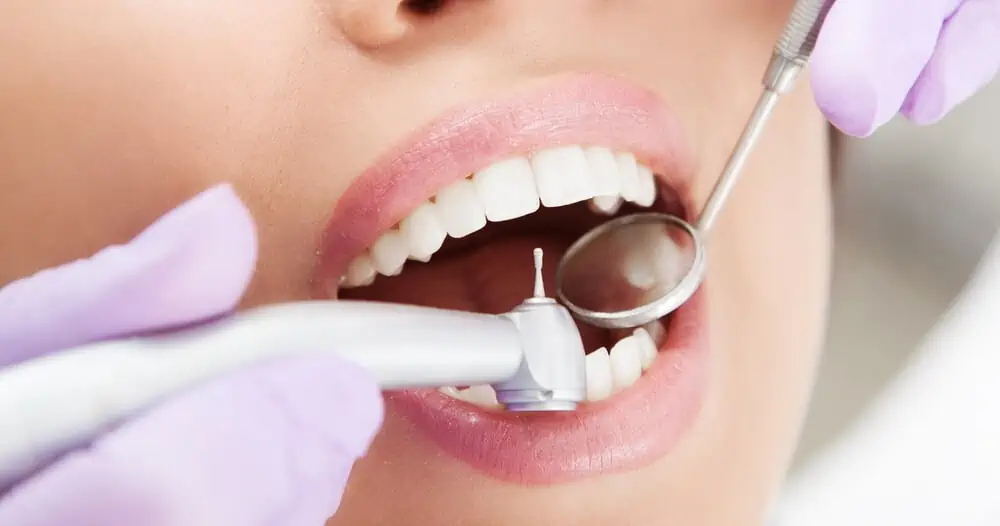 woman getting dental filling