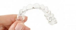 smile direct aligners