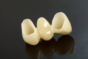 tooth bridge 3 teeth