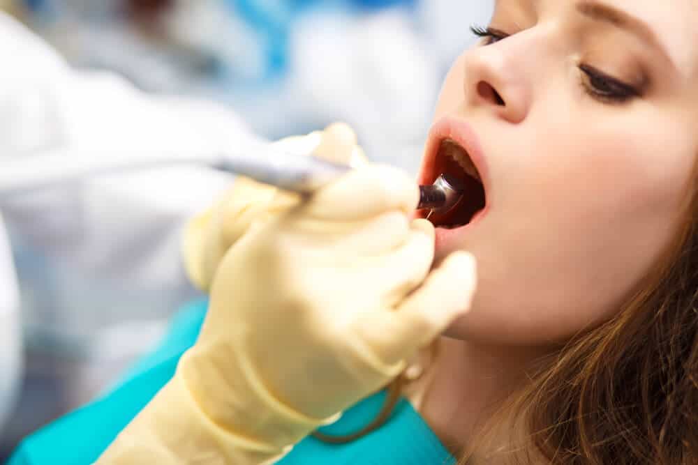 Tooth Filling Costs, Types, Procedure and What to Expect