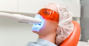 blanchiment des dents chez le dentiste