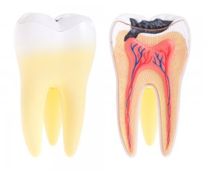 pain from tooth decay