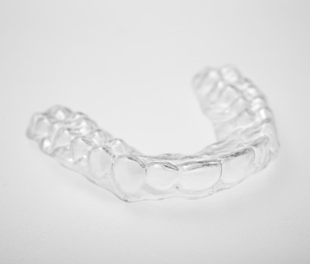 How Much Do Retainers Cost in the UK? Which Type is Best?