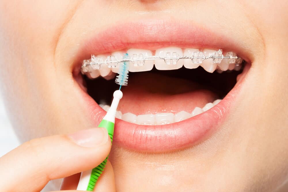 Interdental Brushes Best Brands, Sizes & How to Use Them