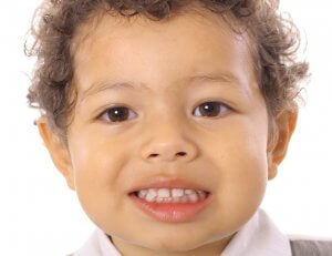 fluoride varnish child