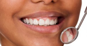 are crest whitening strips safe uk