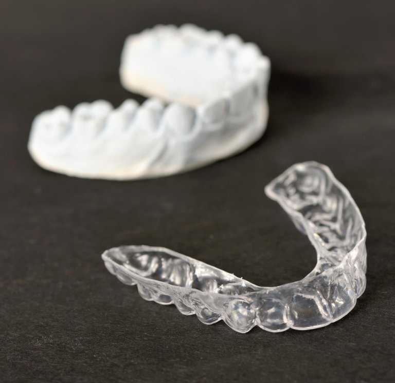Invisalign Alternatives UK: Best & Cheapest Clear Aligners