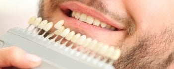 briyte teeth whitening kit review